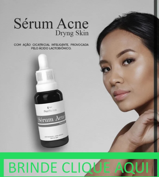 Brinde Serum acne curso dryng skin